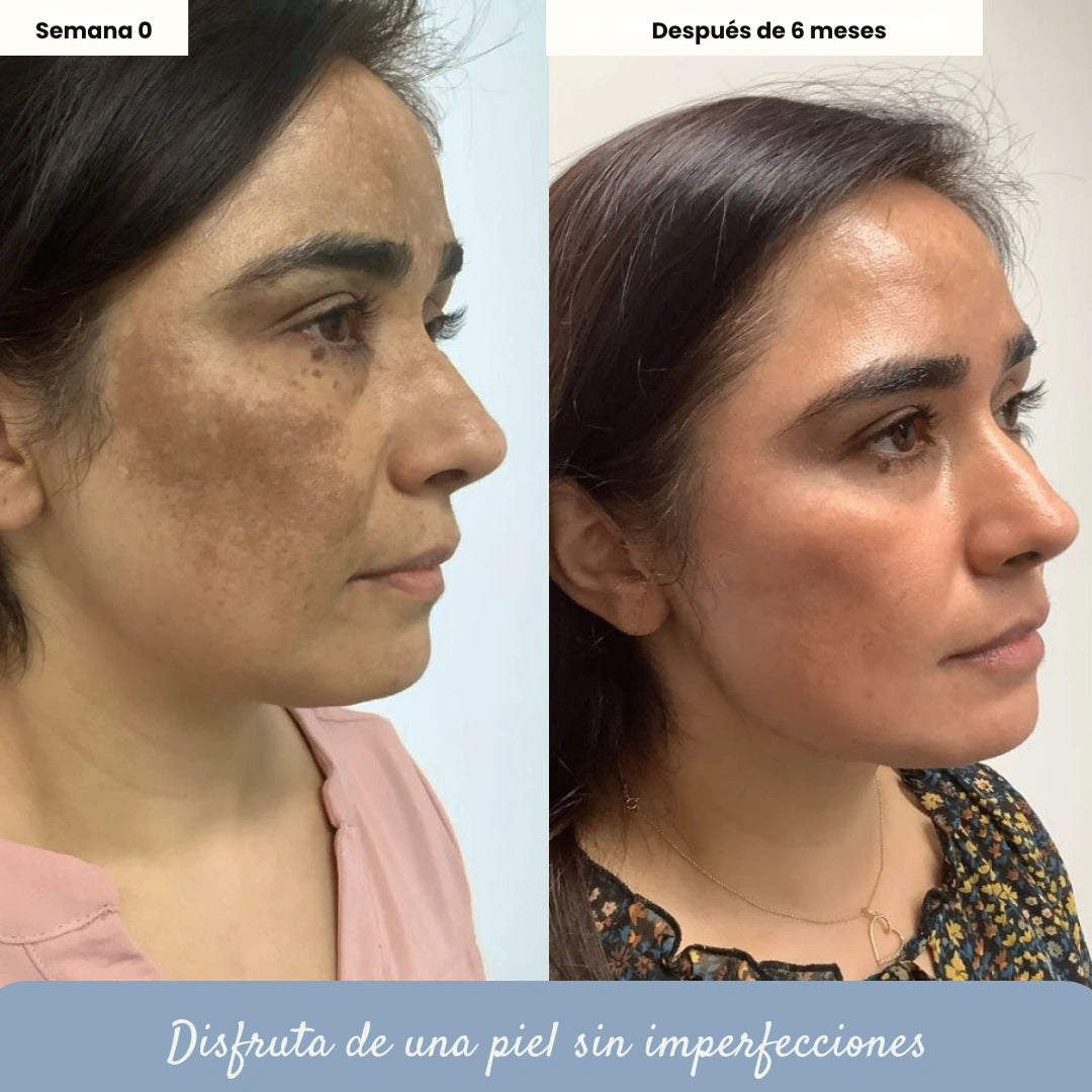 Jabón de curcuma + Ebook Gratuito